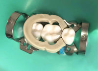 Dental Sectional Matrix Matrices Resin Clip