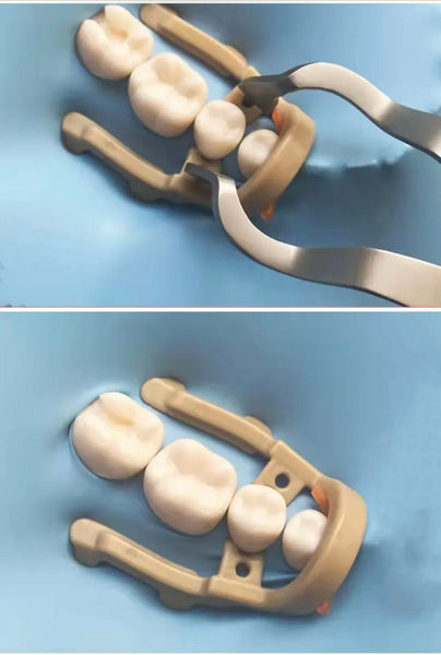 Dental Extension Rubber Dam Clamp Premolar Resin Clip