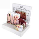 Dental Decay Teeth and Gum Education Demonstration Model     Common Pathologies