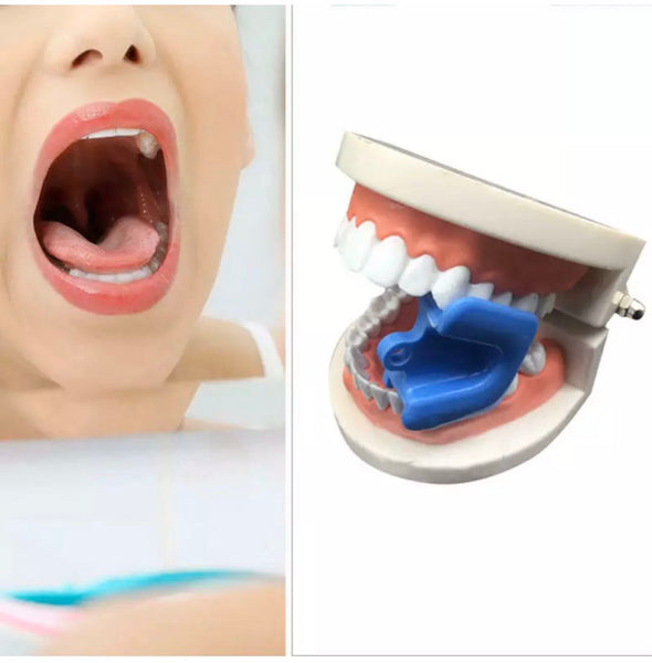 Dental Mouth Bite Block Opener Props