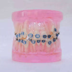 Ortho Metal & Ceramic Bracket Model       Pink
