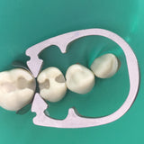 Dental Sectional Matrix Clip Ring Matrices Clamps   Nickel Titanium