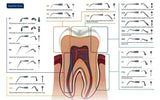 Dental Ultrasonic Scaler Tips  Compatible with Satelec,  NSK, DTE  ED1 , ED2 , ED3 , ED4 , ED5
